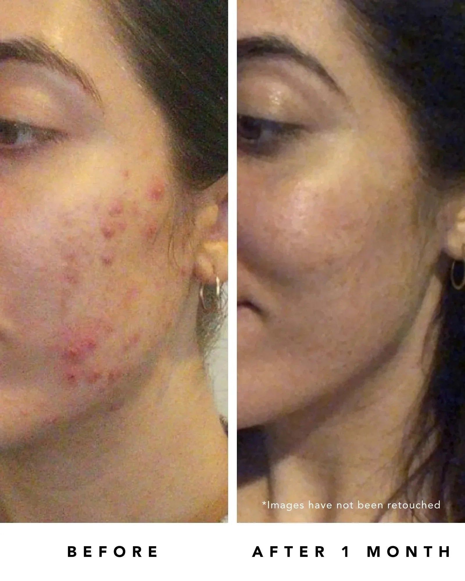 Pores - | Tansy Blue Non-Toxic, Beauty Clean Truly Mask Clarity Natural Resurfacing Natural, Herbivore Invisible